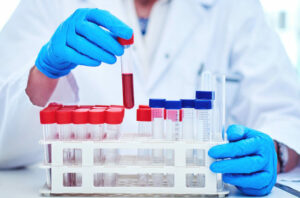 Laboratory Test Price List in the Philippines