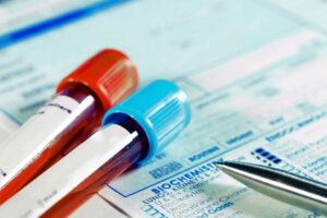 Price List of Laboratory Test