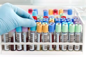 PCSO Medical Assistance for Laboratory